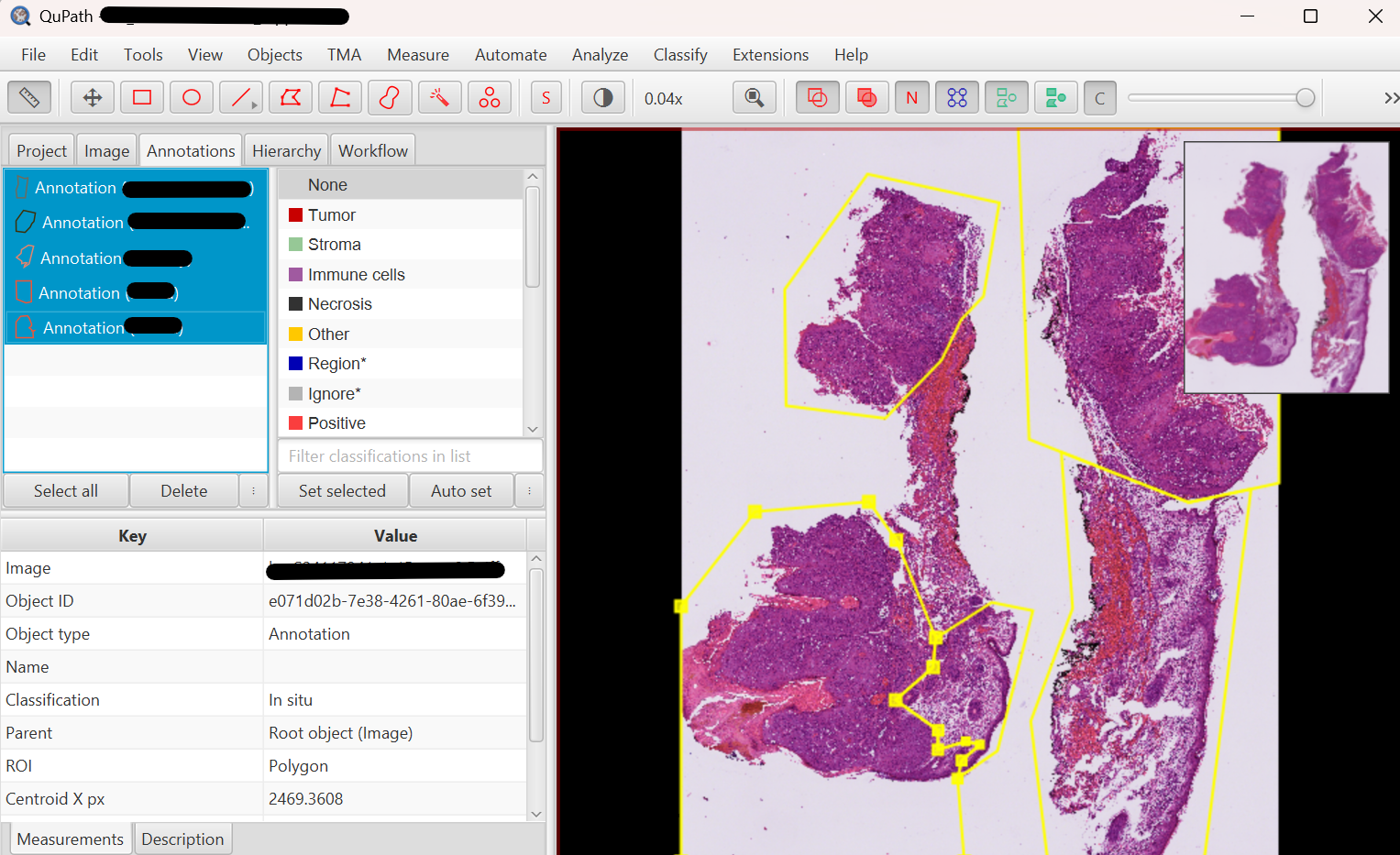 Annotated regions